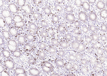 TGF beta Receptor I Mouse Monoclonal Antibody