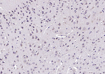 PLEKHO1 Rabbit Polyclonal Antibody