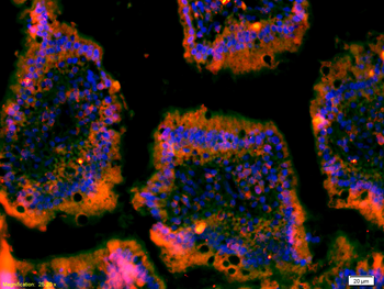 MET Rabbit Polyclonal Antibody
