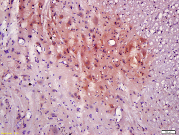 CNTF Rabbit Polyclonal Antibody