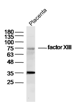 Factor XIII Rabbit Polyclonal Antibody