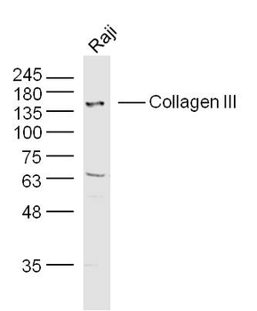 Collagen III Rabbit Polyclonal Antibody