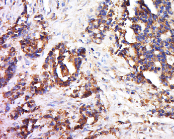 Collagen III Rabbit Polyclonal Antibody