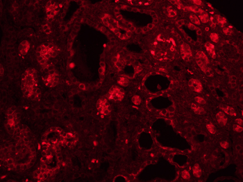 Collagen III Rabbit Polyclonal Antibody
