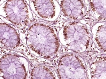 CDX2 Rabbit Polyclonal Antibody