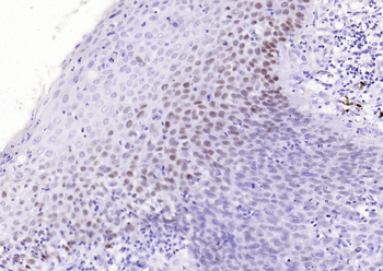 P63 Mouse Monoclonal Antibody