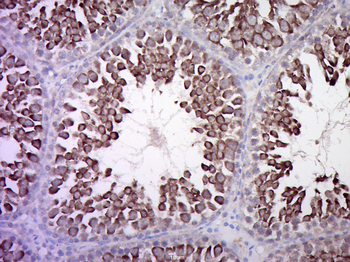 Calcitonin receptor Rabbit Polyclonal Antibody