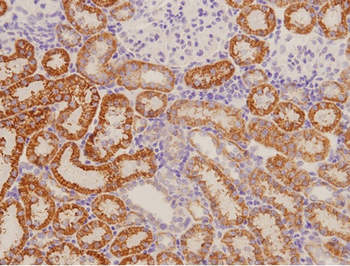 RAMP1 Rabbit Polyclonal Antibody