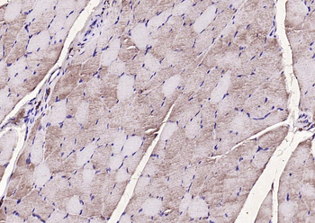 PIK3R1 Rabbit Polyclonal Antibody
