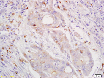CXorf36 Rabbit Polyclonal Antibody