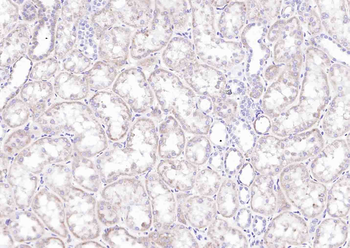 CCN1 Rabbit Polyclonal Antibody