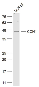 CCN1 Rabbit Polyclonal Antibody