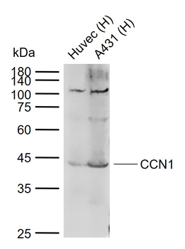 CCN1 Rabbit Polyclonal Antibody