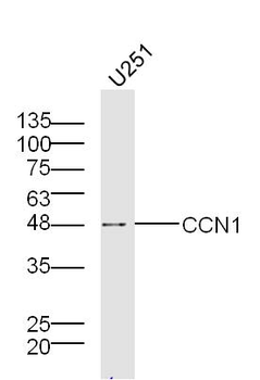 CCN1 Rabbit Polyclonal Antibody