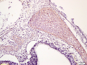 Cytokeratin 1 Rabbit Polyclonal Antibody