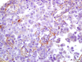 HCMV pp65 Rabbit Polyclonal Antibody