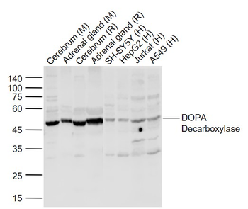 DOPA Decarboxylase Rabbit Polyclonal Antibody