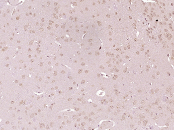 Deltex 1 Rabbit Polyclonal Antibody