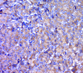 DISC1 (CT) Rabbit Polyclonal Antibody