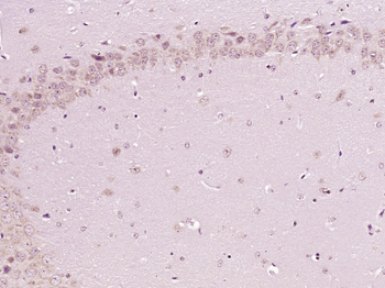 DISC1 (NT) Rabbit Polyclonal Antibody