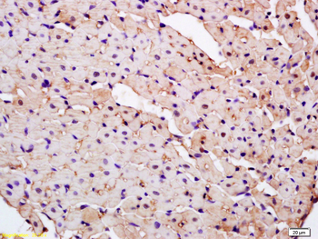 PARK7/DJ1 Rabbit Polyclonal Antibody
