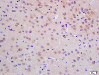 DUTPase Rabbit Polyclonal Antibody