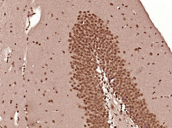 E2F1 Rabbit Polyclonal Antibody