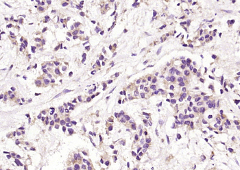 SPINK7 Rabbit Polyclonal Antibody