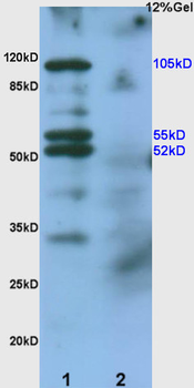 EphA2 Rabbit Polyclonal Antibody