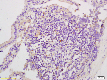 EphA2 Rabbit Polyclonal Antibody