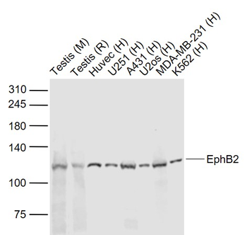 EphB2 Rabbit Polyclonal Antibody