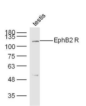 EphB2 Rabbit Polyclonal Antibody