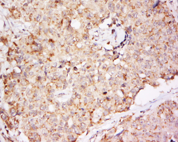 EphB2 Rabbit Polyclonal Antibody