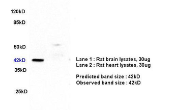 ERK1 + ERK2 Rabbit Polyclonal Antibody