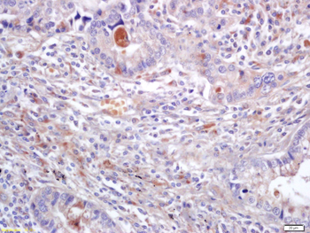 ERK1 + ERK2 Rabbit Polyclonal Antibody