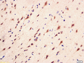 Phospho-PI3 kinase p85 alpha + gamma (Tyr467 + Tyr199) Rabbit Polyclonal Antibody