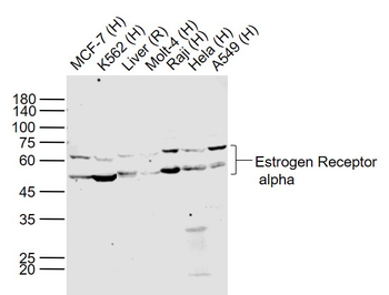 Estrogen Receptor alpha Rabbit Polyclonal Antibody