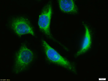 Estrogen Receptor alpha Rabbit Polyclonal Antibody