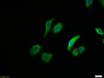 Estrogen Receptor alpha Rabbit Polyclonal Antibody