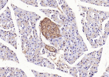 Phospho-STAT3 (Tyr705) Rabbit Polyclonal Antibody