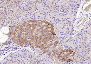 Phospho-STAT3 (Tyr705) Rabbit Polyclonal Antibody
