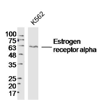 Estrogen receptor alpha Rabbit Polyclonal Antibody