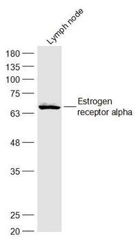 Estrogen receptor alpha Rabbit Polyclonal Antibody