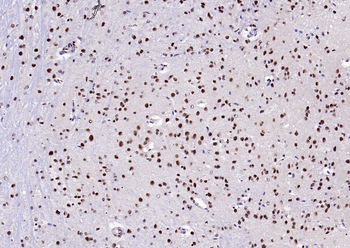 Estrogen receptor beta Rabbit Polyclonal Antibody
