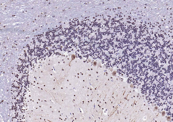 Estrogen receptor beta Rabbit Polyclonal Antibody