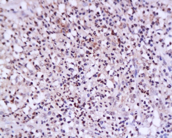 ETS1 Rabbit Polyclonal Antibody