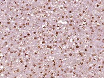 Phospho-LKB1 (Ser428) Rabbit Polyclonal Antibody