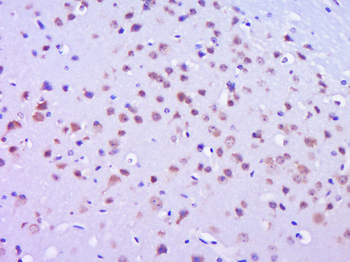 Phospho-FAK (Tyr577) Rabbit Polyclonal Antibody