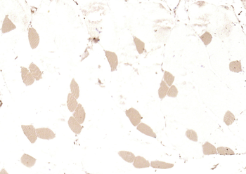 MYH7 Rabbit Polyclonal Antibody