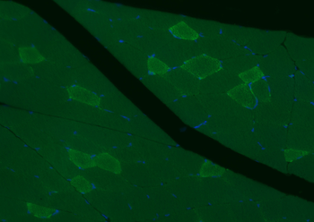 MYH7 Rabbit Polyclonal Antibody